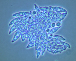 The seagrass pathogen