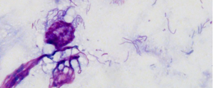 Cell-free polymorphic rickettsiae. Visualized by the Diff-Quik staining method.