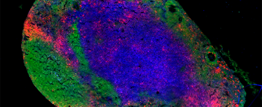 A549 airway epithelial cells grown in tissue culture.