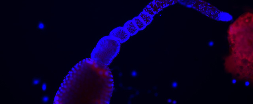 Dissected cat flea ovary. Specimen stained blue (Nuclei) and red (flea tissue). Visualized using fluorescence microscopy.