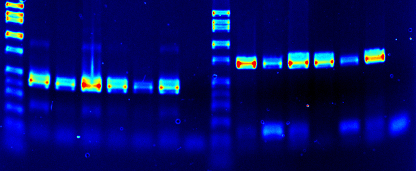 Spectrum enhanced (false colored) agarose gel DNA picture.