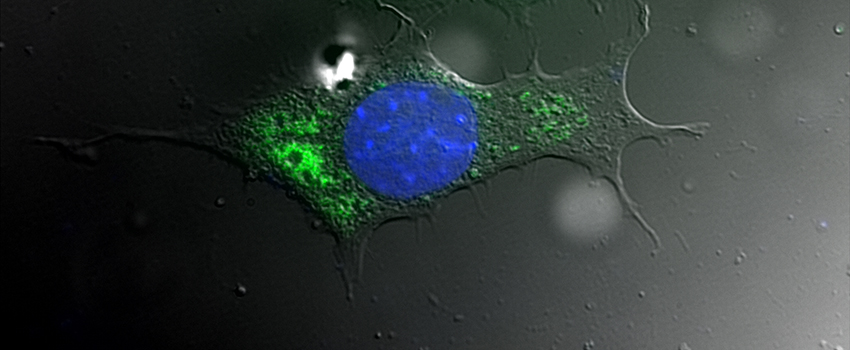 DIC and fluorescent microscopy images overlaid to show the entire host cell (gray with blue nucleus) and intracellular bacteria (green).