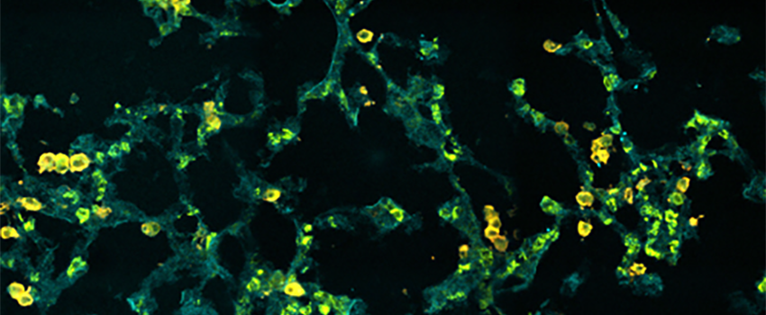 Immunostaining of the alveolar space within cryopreserved mouse lungs.  Image captured by confocal hyperspectral microscopy.