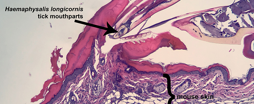 Histopathology of Haemaphysalis longicornis tick (i.e. Asian longhorned tick) feeding site.