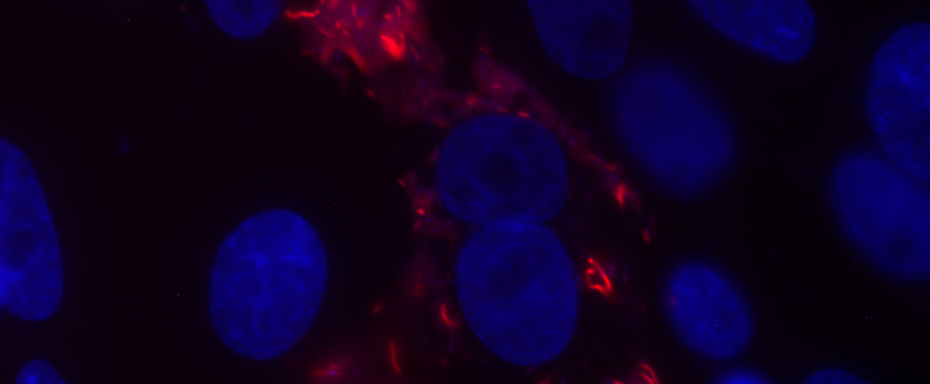 Fluorescent microscopy of intracellular bacteria (red) within the host cell (blue nucleus).