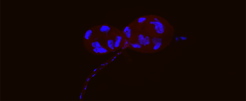 Dissected cat flea salivary glands. Specimen stained blue (Nuclei) and red (flea tissue). Visualized using fluorescence microscopy.