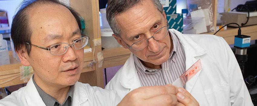 Dr. Mike Lin, left, and Dr. Ron Balczon work in Dr. Lin's lab at the USA College of Medicine. They are conducting research into a possible link between hospital-acquired bacterial pneumonia and cognitive impairment.  