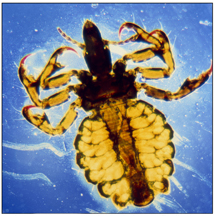 A light micrograph of a body louse (Pediculus humanus corporis). Lice can transmit diseases such as typhus and relapsing fever to humans.