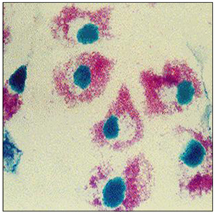 Stained Rickettsia prowazekii (red) in a host cell