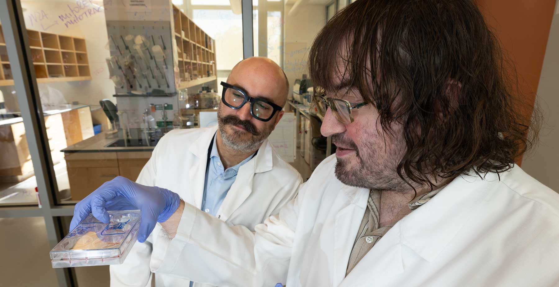 USA Study Reveals Pathway in Cancer Metastasis
